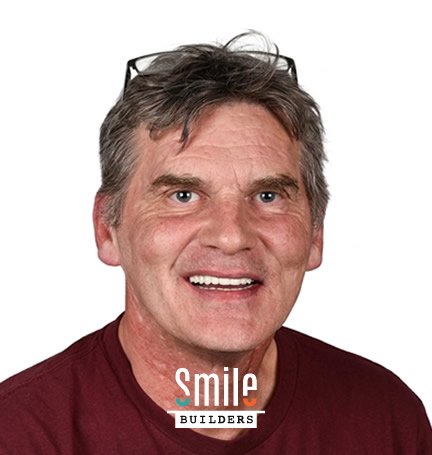 smile-builders-dental-after-patient-tijuana-mexico-4