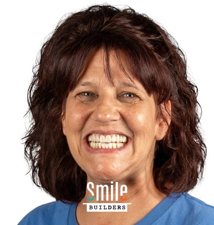 smile-builders-dental-after-patient-tijuana-mexico-6